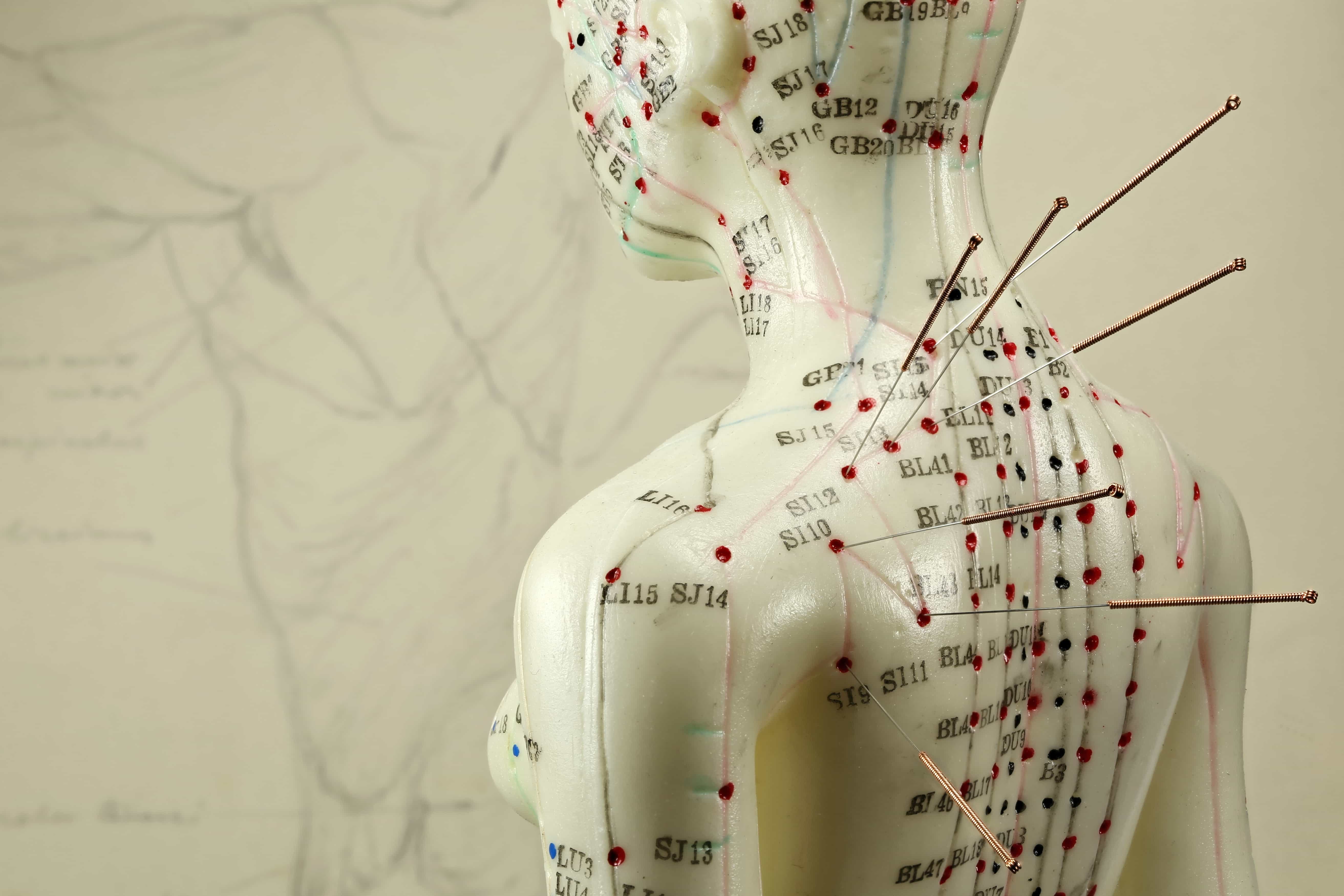 Cabinet medical - Dr Henri-Kim de Heller - acupuncture